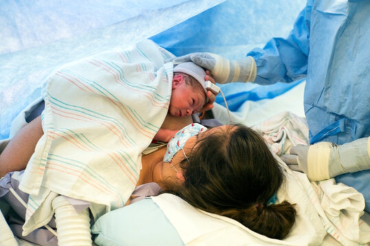 Caesarean (C-section) Delivery