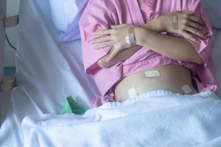 Laparoscopic removal of ovarian cysts & fibroids-------19